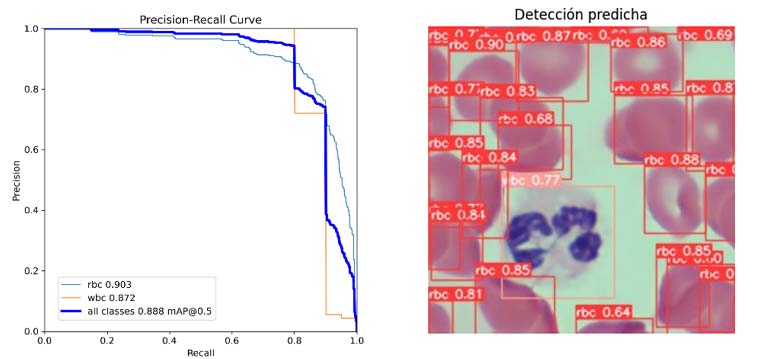 Detección predictiva