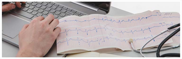 IA paradas cardiacas