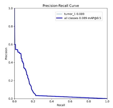 Predictiva